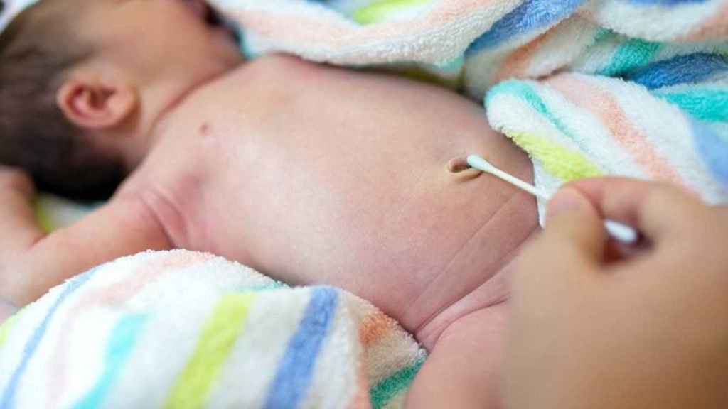 Gejala Hernia Pada Bayi dan Cara Menanganinya