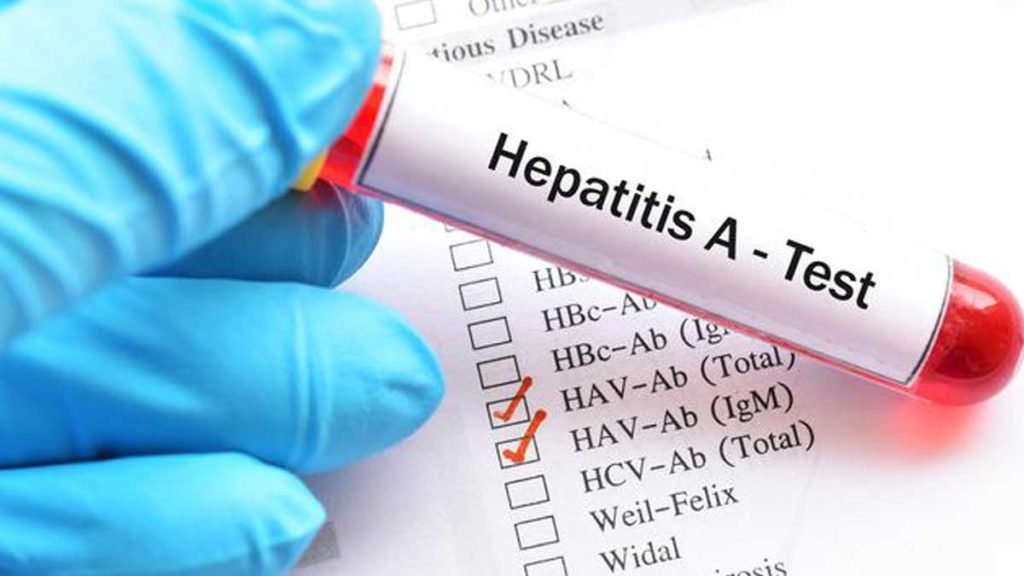 Pencegahan dan Pengobatan Hepatitis A