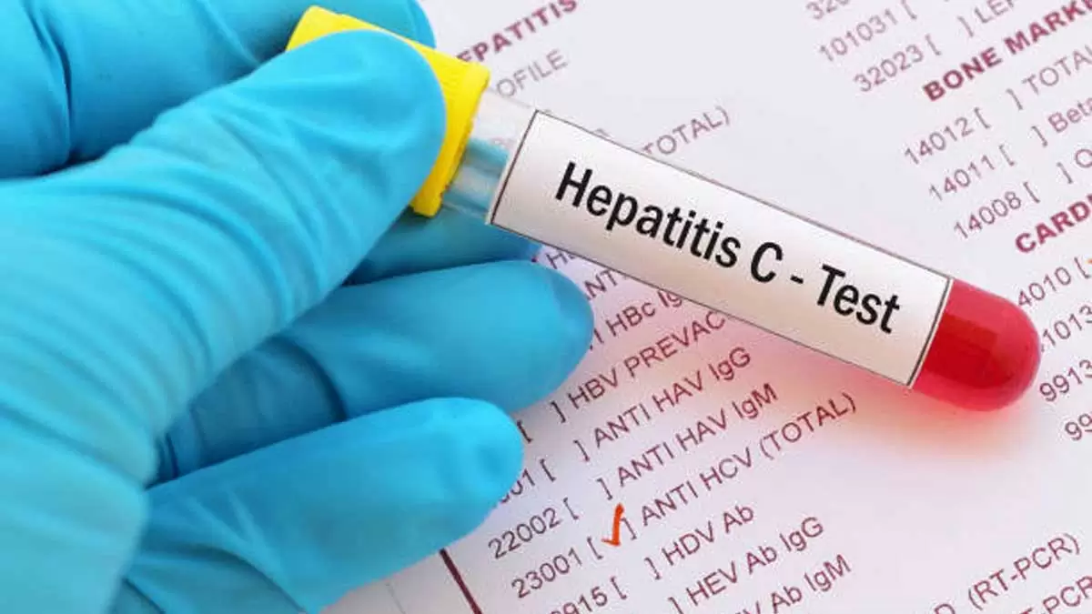 Pengobatan Hepatitis C