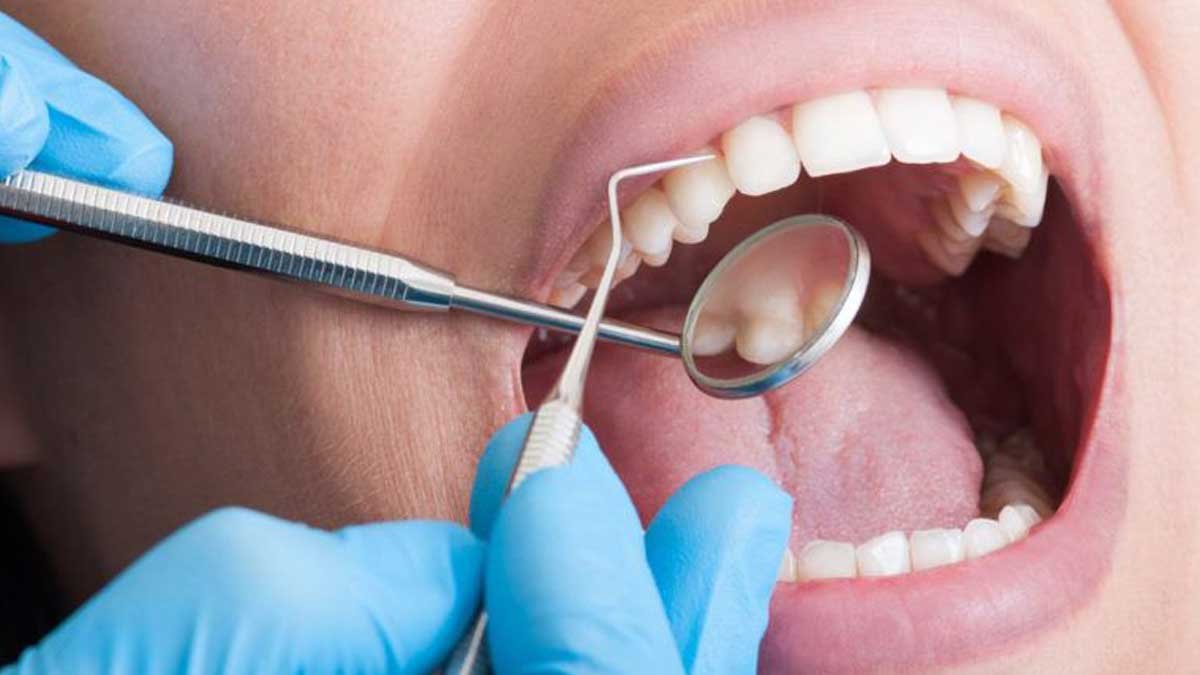 Dental Contouring