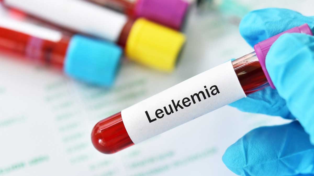 Leukemia - Gejala, Penyebab Dan Cara Mengobatinya - MHomecare