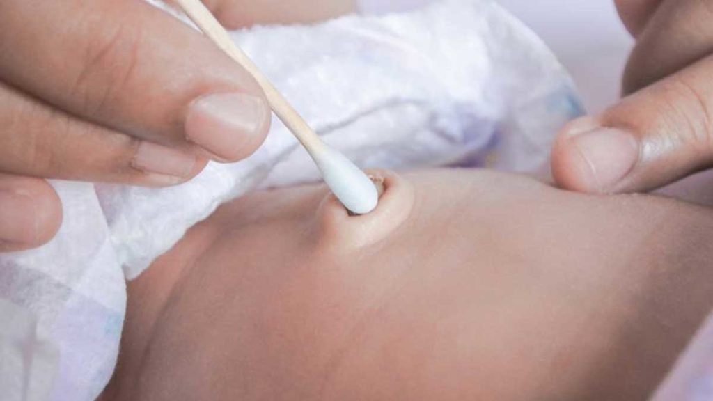 Pusar Bayi Berdarah, Inilah Penyebab Dan Cara Menanganinya