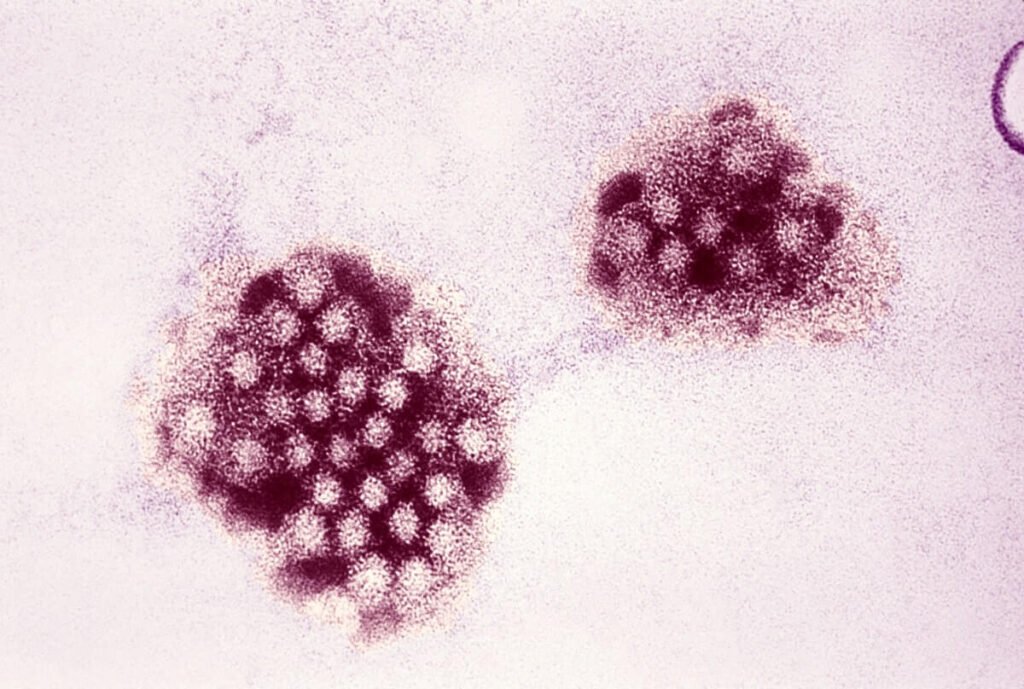 Norovirus di Indonesia