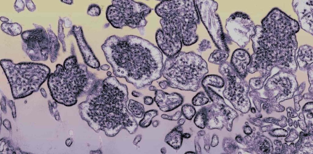 Nipah Virus