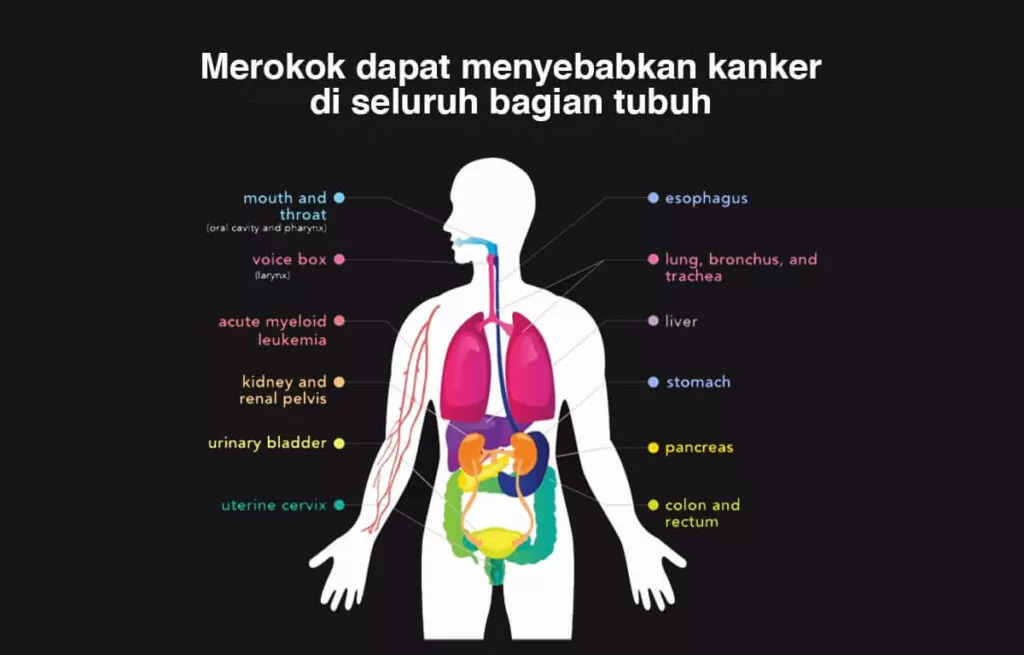 Bahaya rokok menyebabkan kanker