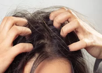 Penyebab rambut gatal