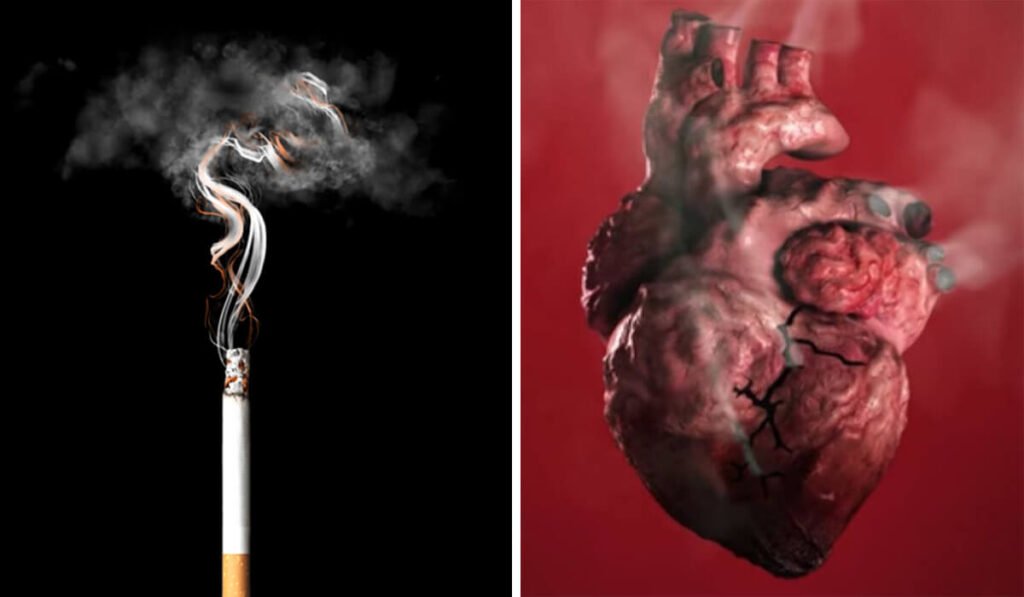 Dampak Buruk Rokok Terhadap Kesehatan Jantung